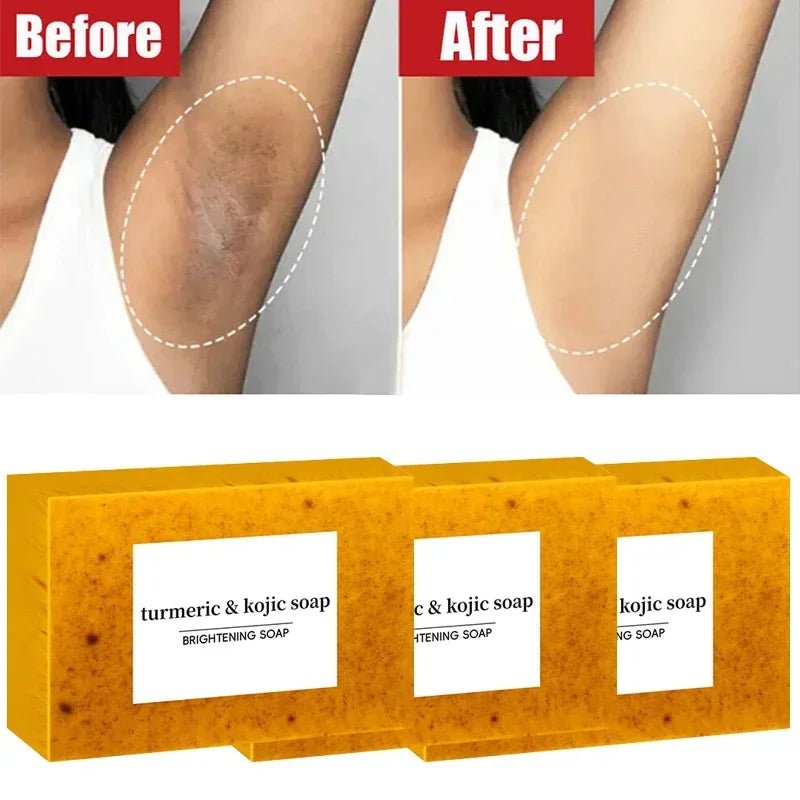 Turmeric Kojic Acid Soap - Brightening Exfoliator - BeyoutifulSpot®