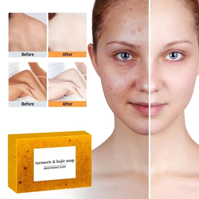 Turmeric Kojic Acid Soap - Brightening Exfoliator - BeyoutifulSpot®